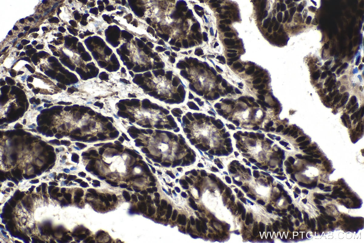 Immunohistochemistry (IHC) staining of mouse colon tissue using CCAR1 Polyclonal antibody (25232-1-AP)
