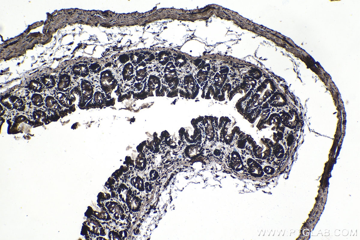 Immunohistochemistry (IHC) staining of rat colon tissue using CCAR1 Polyclonal antibody (25232-1-AP)