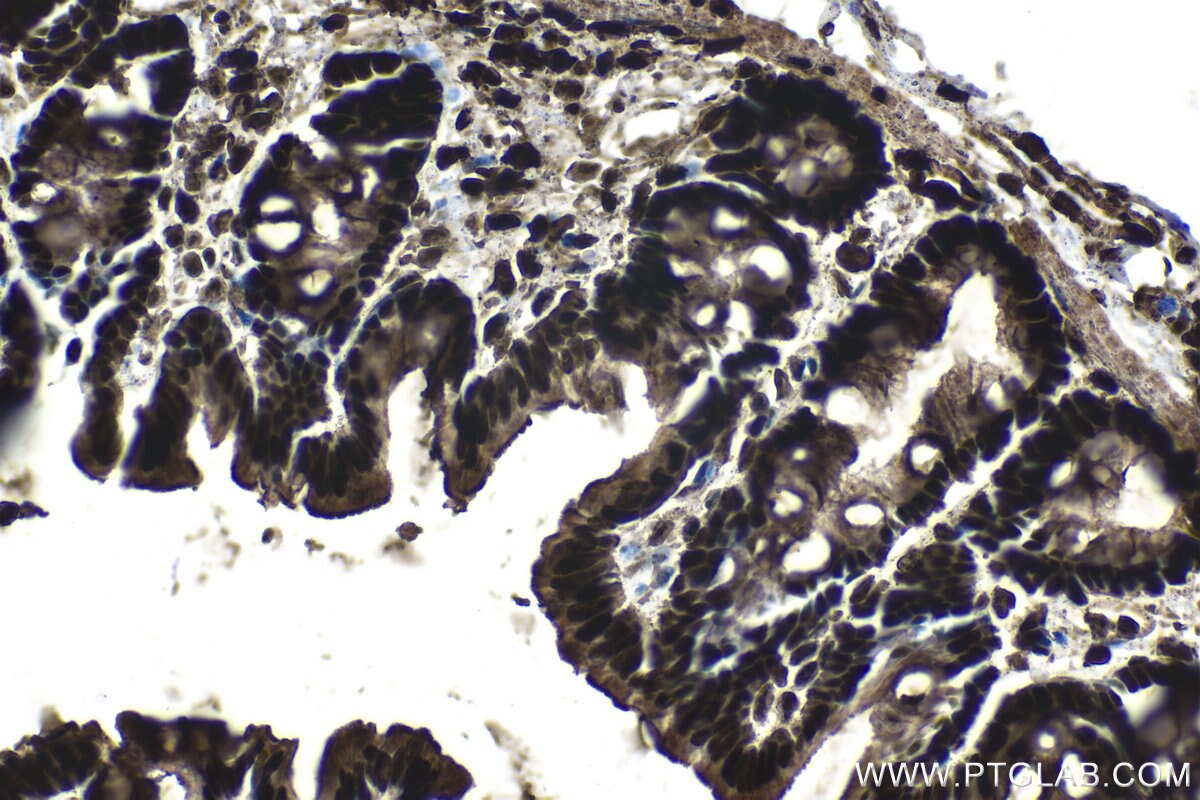 Immunohistochemistry (IHC) staining of rat colon tissue using CCAR1 Polyclonal antibody (25232-1-AP)