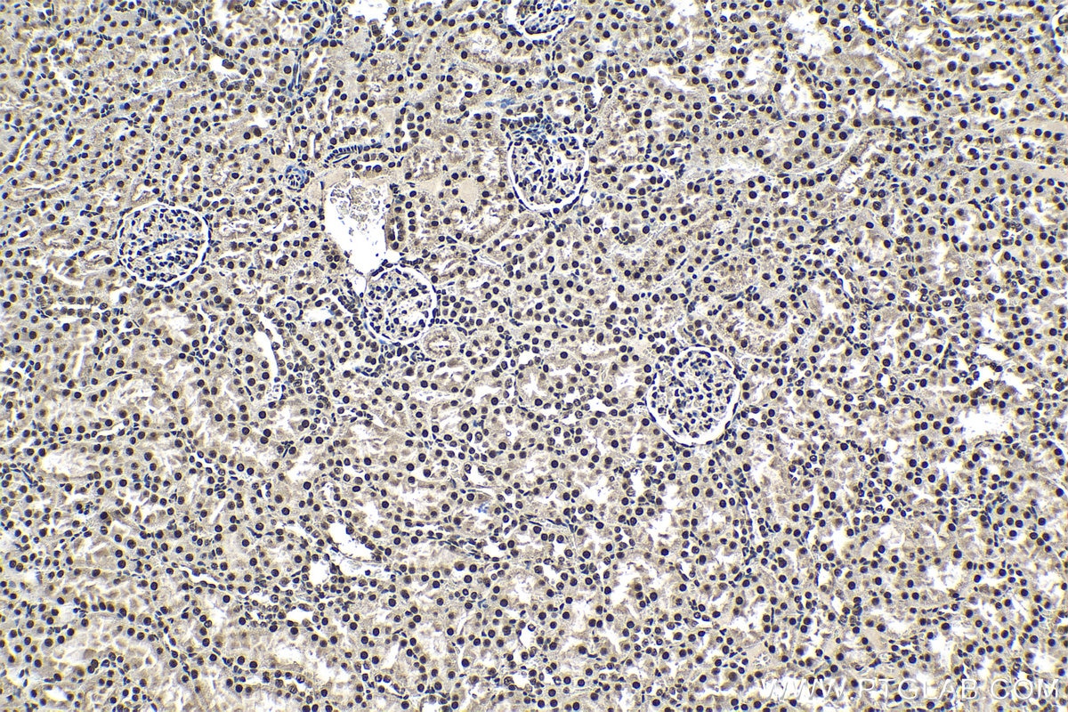 Immunohistochemistry (IHC) staining of rat kidney tissue using CCAR1 Polyclonal antibody (25232-1-AP)