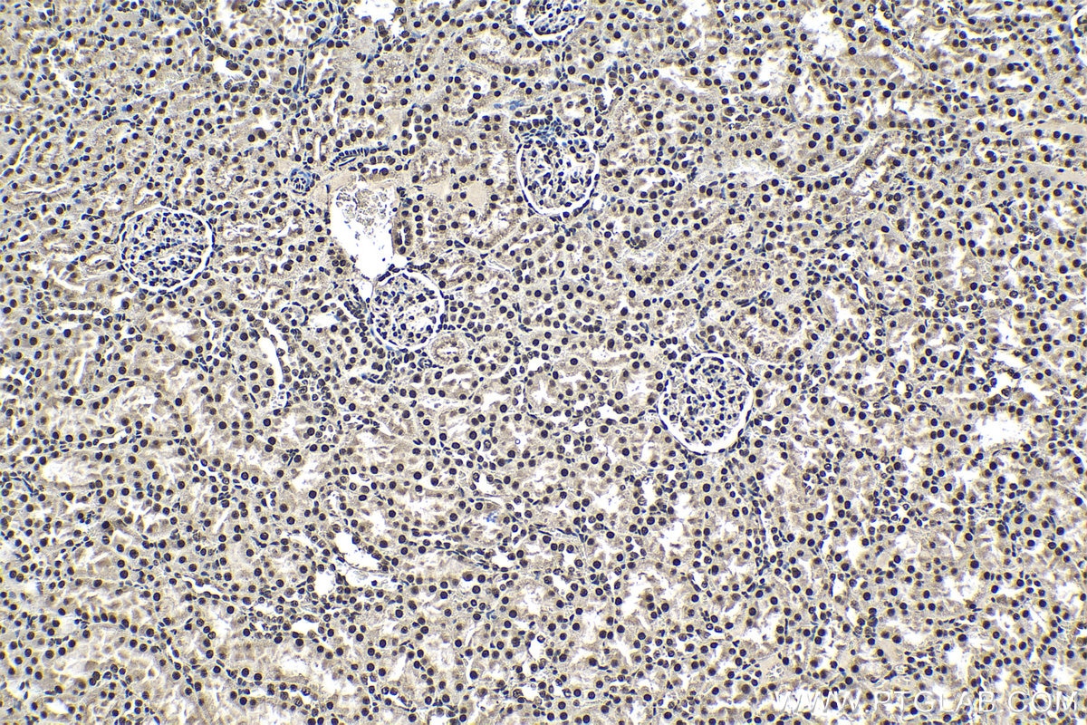 Immunohistochemistry (IHC) staining of rat kidney tissue using CCAR1 Polyclonal antibody (25232-1-AP)