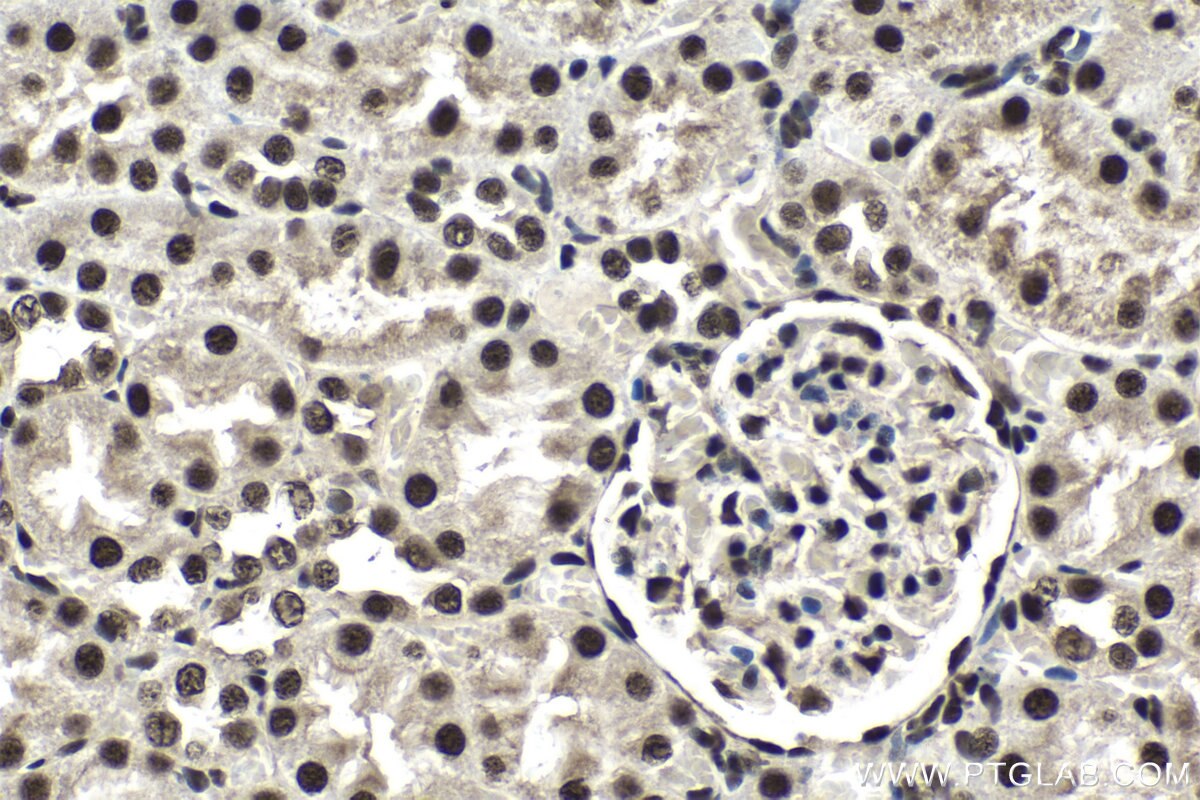 Immunohistochemistry (IHC) staining of rat kidney tissue using CCAR1 Polyclonal antibody (25232-1-AP)