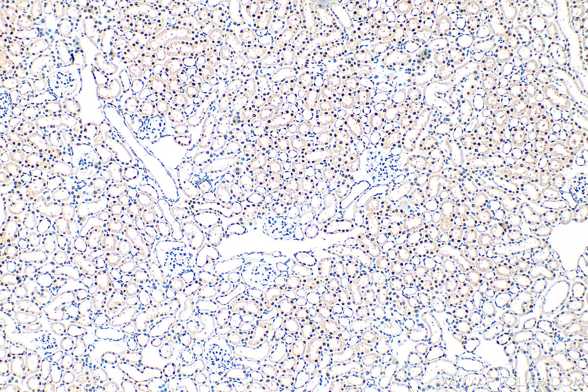 Immunohistochemistry (IHC) staining of mouse kidney tissue using CCAR1 Polyclonal antibody (25232-1-AP)