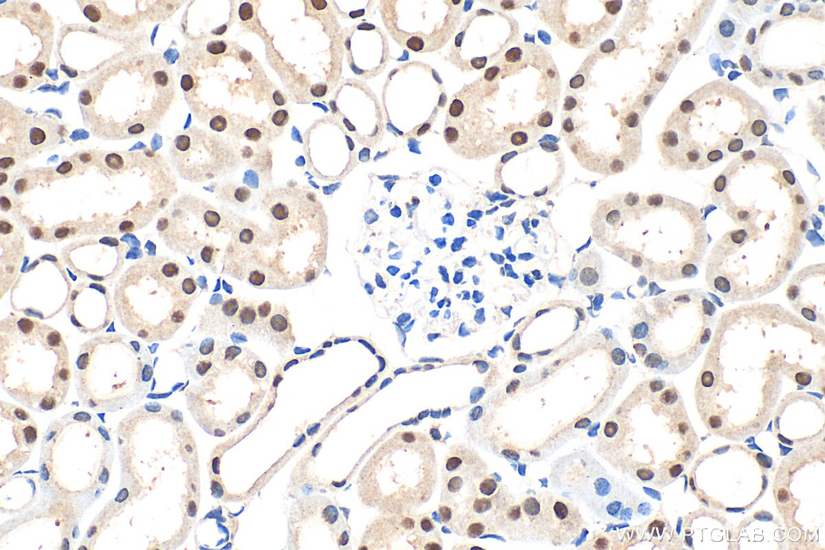 Immunohistochemistry (IHC) staining of mouse kidney tissue using CCAR1 Polyclonal antibody (25232-1-AP)