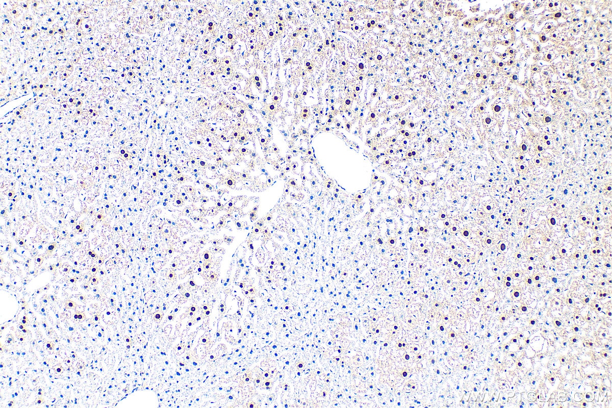 Immunohistochemistry (IHC) staining of mouse liver tissue using CCAR1 Polyclonal antibody (25232-1-AP)