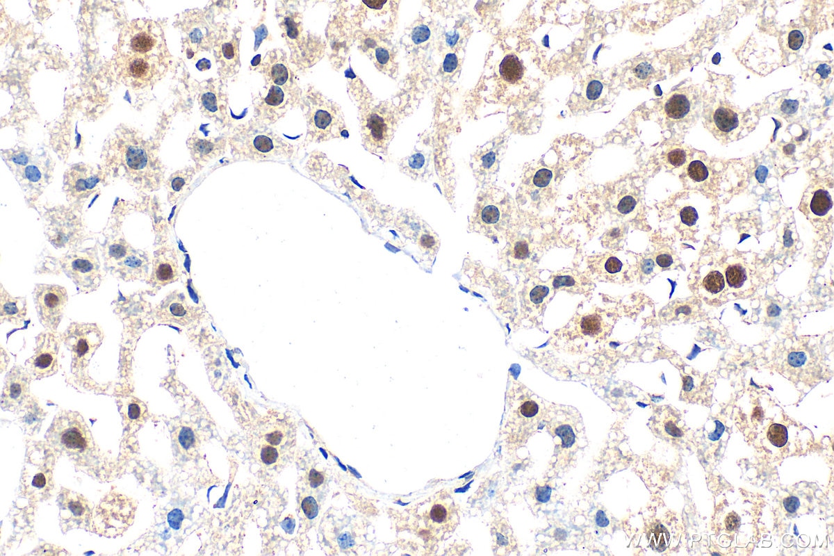 Immunohistochemistry (IHC) staining of mouse liver tissue using CCAR1 Polyclonal antibody (25232-1-AP)