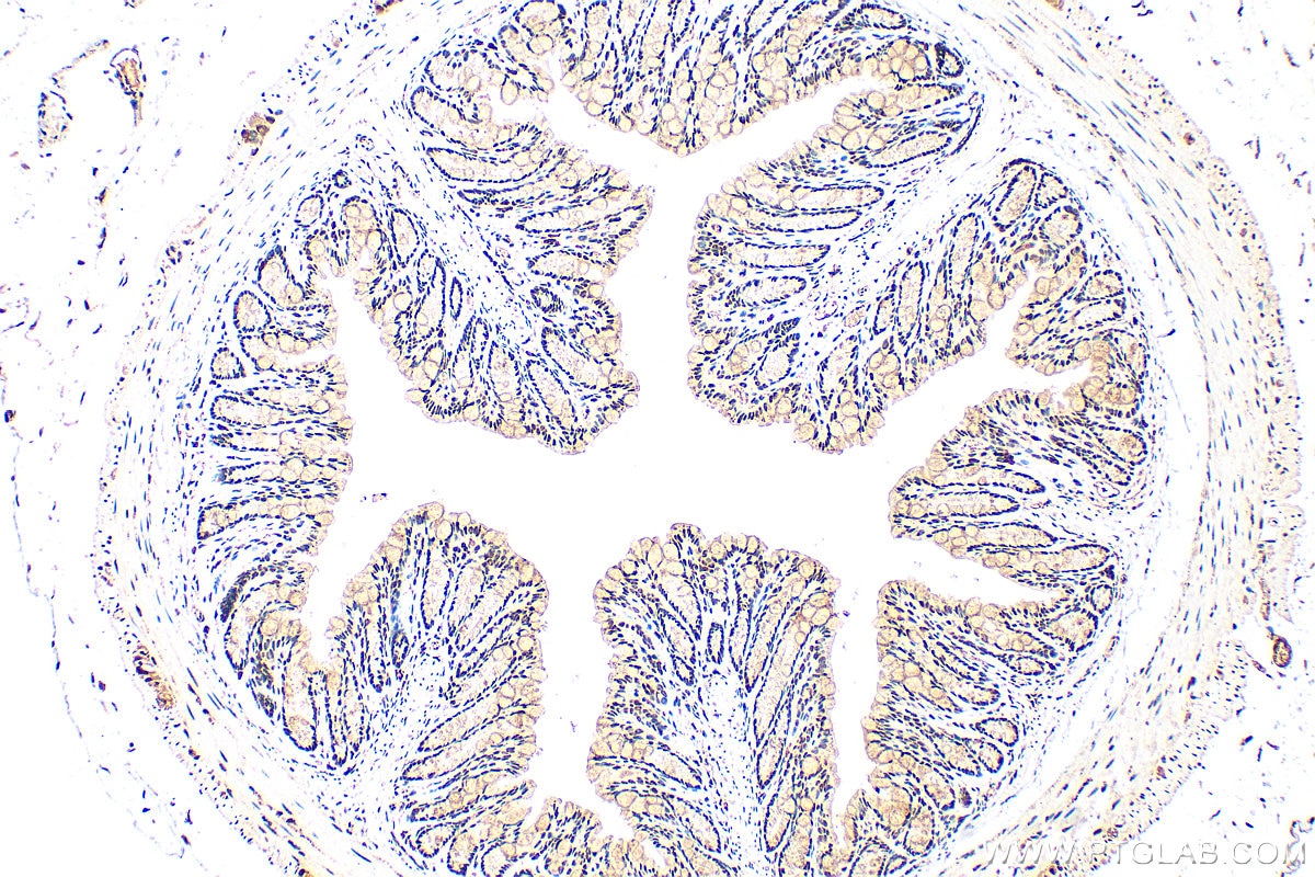 Immunohistochemistry (IHC) staining of mouse colon tissue using CCAR1 Polyclonal antibody (25232-1-AP)