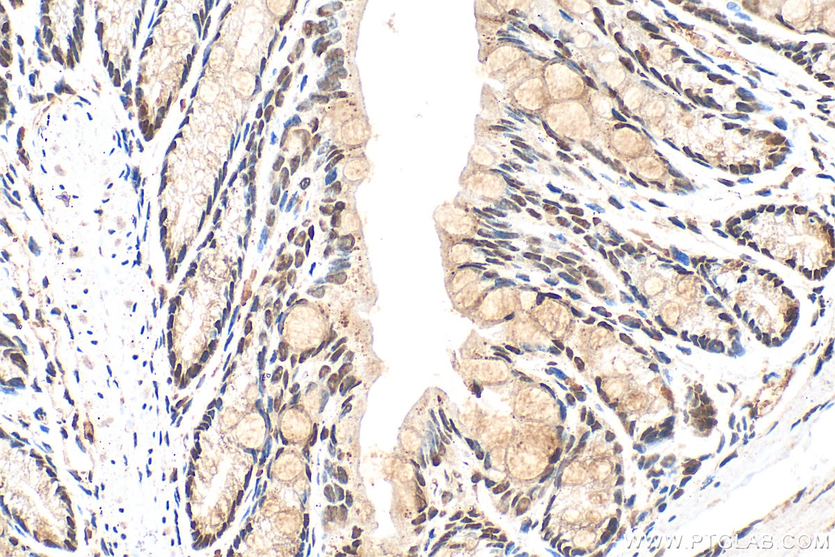 Immunohistochemistry (IHC) staining of mouse colon tissue using CCAR1 Polyclonal antibody (25232-1-AP)