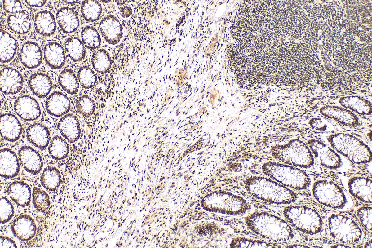 Immunohistochemistry (IHC) staining of human colon tissue using CCAR1 Polyclonal antibody (25232-1-AP)