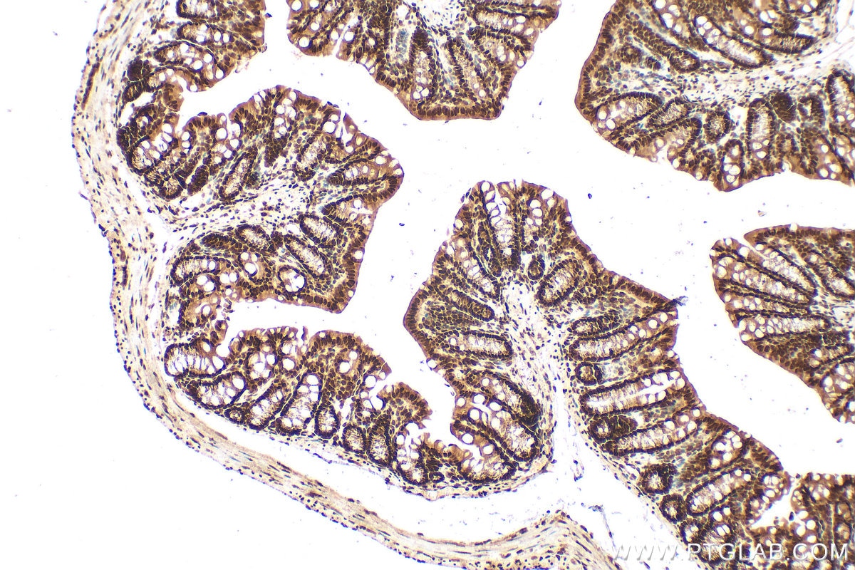 Immunohistochemistry (IHC) staining of mouse colon tissue using CCAR1 Polyclonal antibody (25232-1-AP)