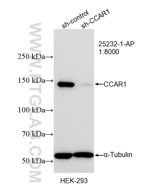 Western Blot (WB) analysis of HEK-293 cells using CCAR1 Polyclonal antibody (25232-1-AP)