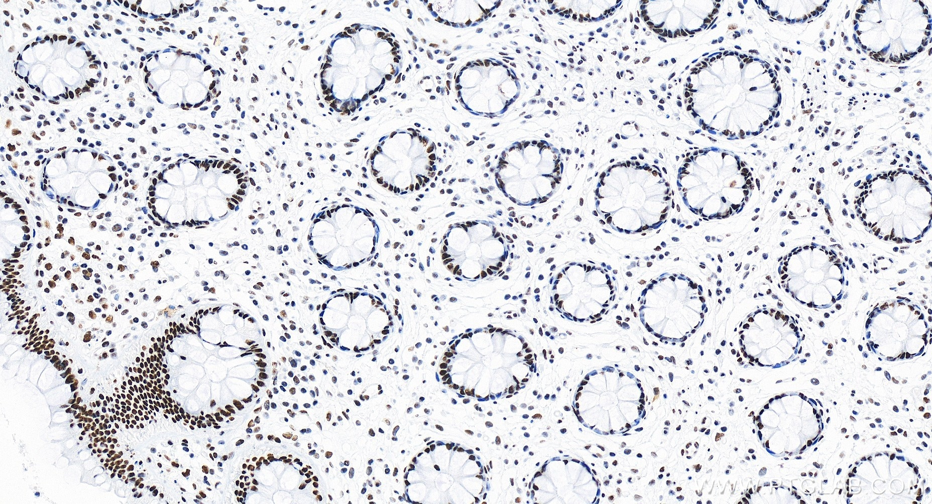 Immunohistochemistry (IHC) staining of human colon tissue using CCAR1 Recombinant antibody (83936-4-RR)