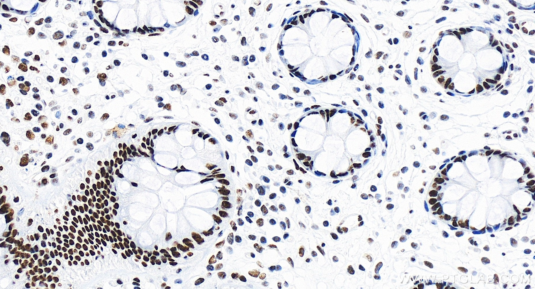Immunohistochemistry (IHC) staining of human colon tissue using CCAR1 Recombinant antibody (83936-4-RR)