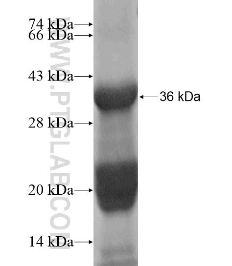 CCAR1 fusion protein Ag18970 SDS-PAGE
