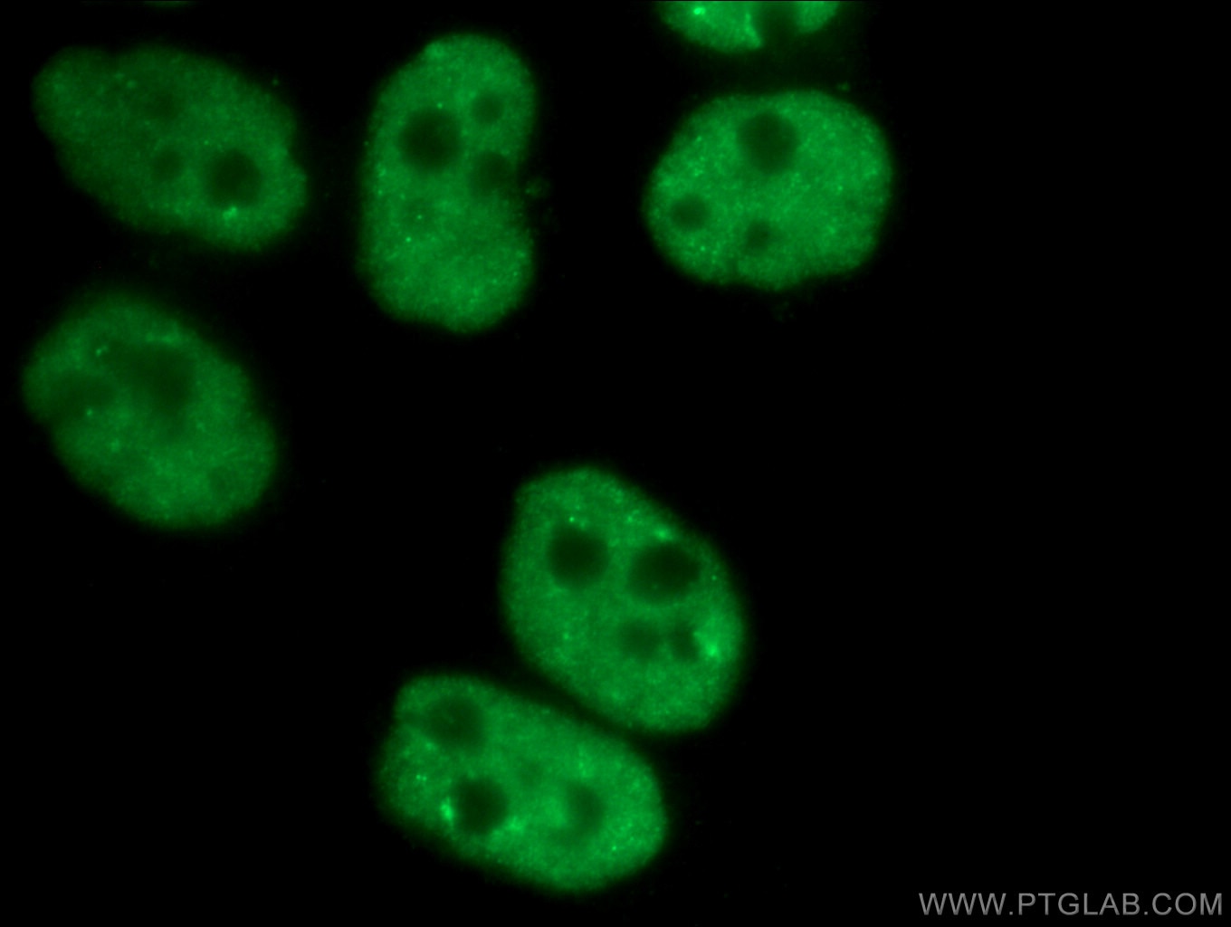 Immunofluorescence (IF) / fluorescent staining of HeLa cells using CCAR2 Monoclonal antibody (66497-1-Ig)