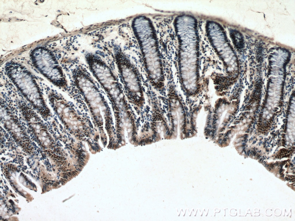 IHC staining of human colon using 66497-1-Ig