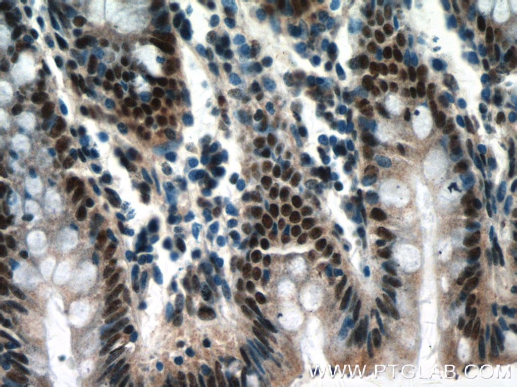 Immunohistochemistry (IHC) staining of human colon tissue using CCAR2 Monoclonal antibody (66497-1-Ig)