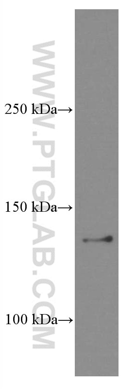 Western Blot (WB) analysis of pig brain tissue using CCAR2 Monoclonal antibody (66497-1-Ig)