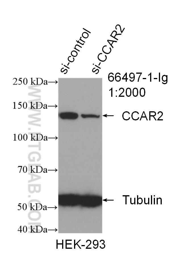 Western Blot (WB) analysis of HEK-293 cells using CCAR2 Monoclonal antibody (66497-1-Ig)