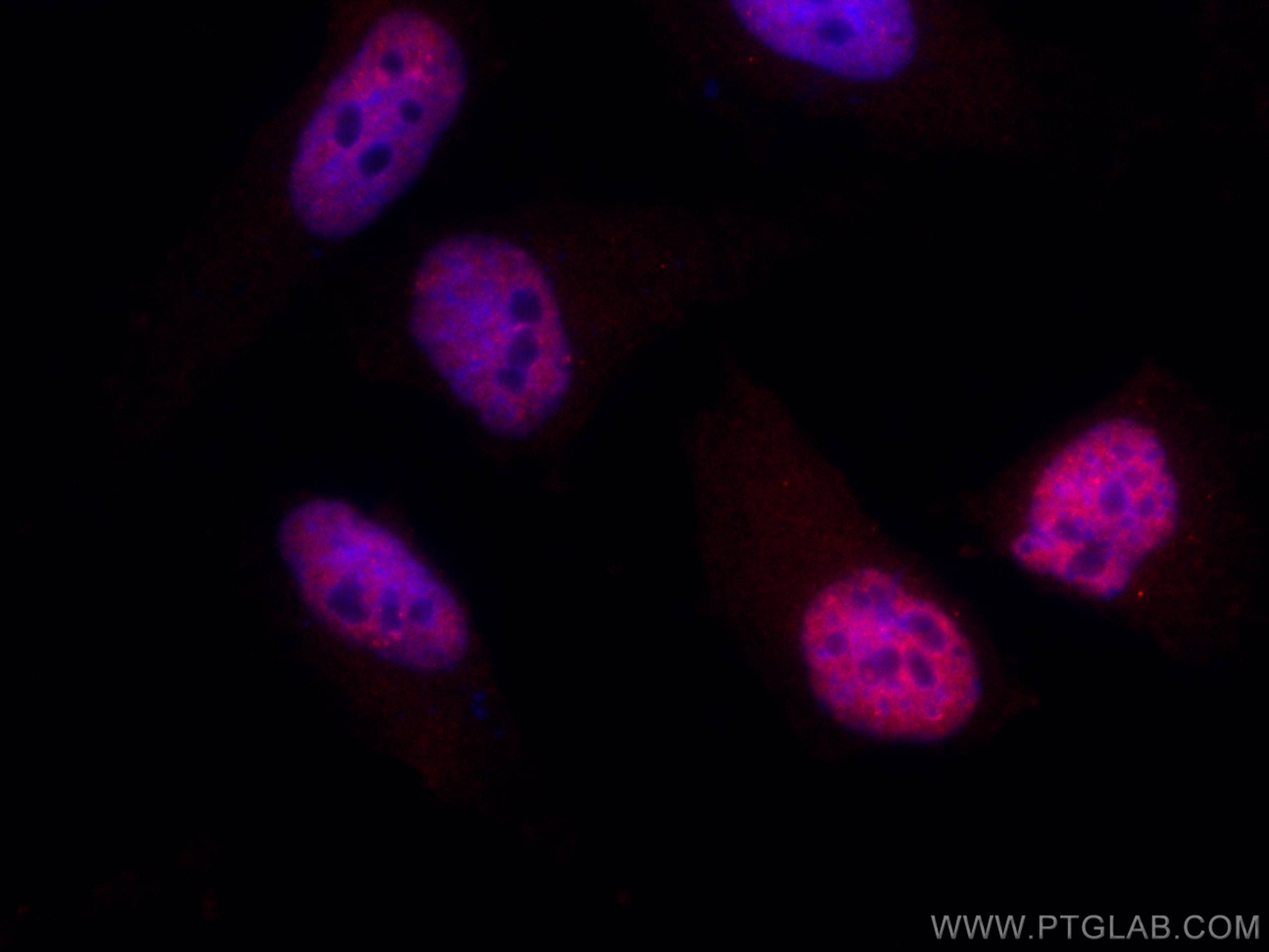 Immunofluorescence (IF) / fluorescent staining of HeLa cells using CoraLite®594-conjugated CCAR2 Monoclonal antibody (CL594-66497)