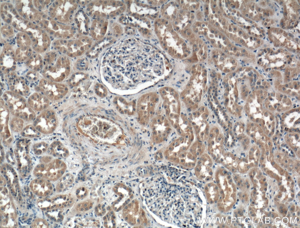 Immunohistochemistry (IHC) staining of human kidney tissue using CCBE1 Polyclonal antibody (24449-1-AP)