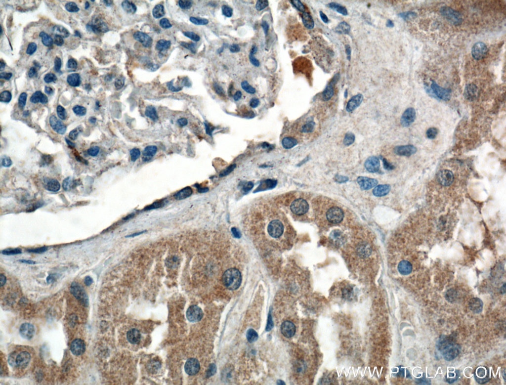 Immunohistochemistry (IHC) staining of human kidney tissue using CCBE1 Polyclonal antibody (24449-1-AP)