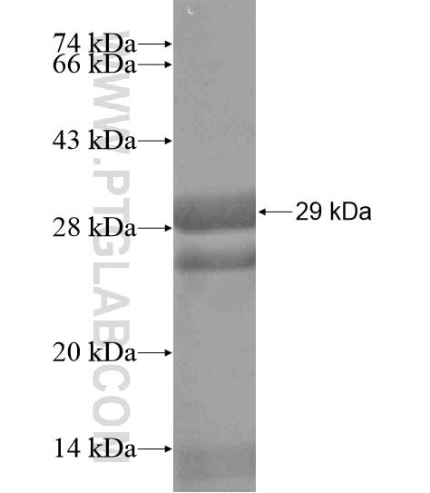 CCBE1 fusion protein Ag19686 SDS-PAGE