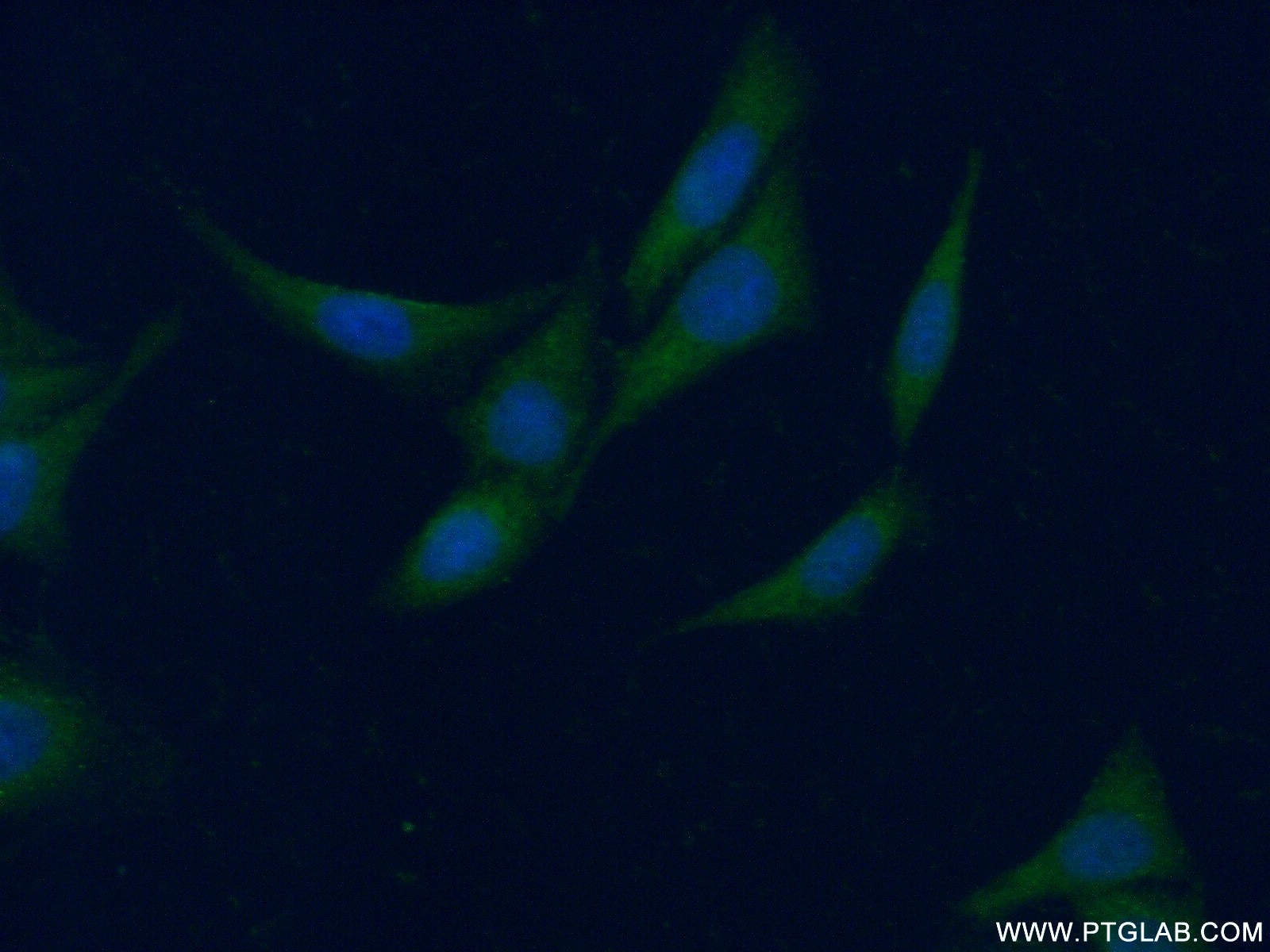 Immunofluorescence (IF) / fluorescent staining of HeLa cells using CCBL1/KAT1 Polyclonal antibody (12156-1-AP)