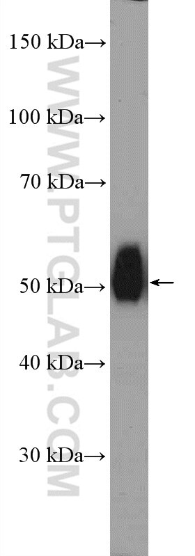 Western Blot (WB) analysis of mouse kidney tissue using CCBL1/KAT1 Polyclonal antibody (12156-1-AP)