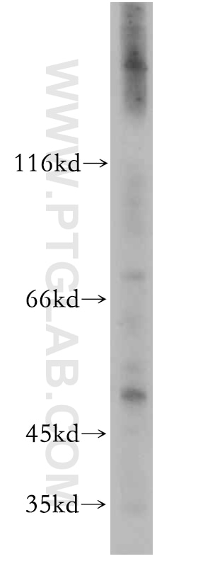 Western Blot (WB) analysis of L02 cells using CCBL1/KAT1 Polyclonal antibody (12156-1-AP)