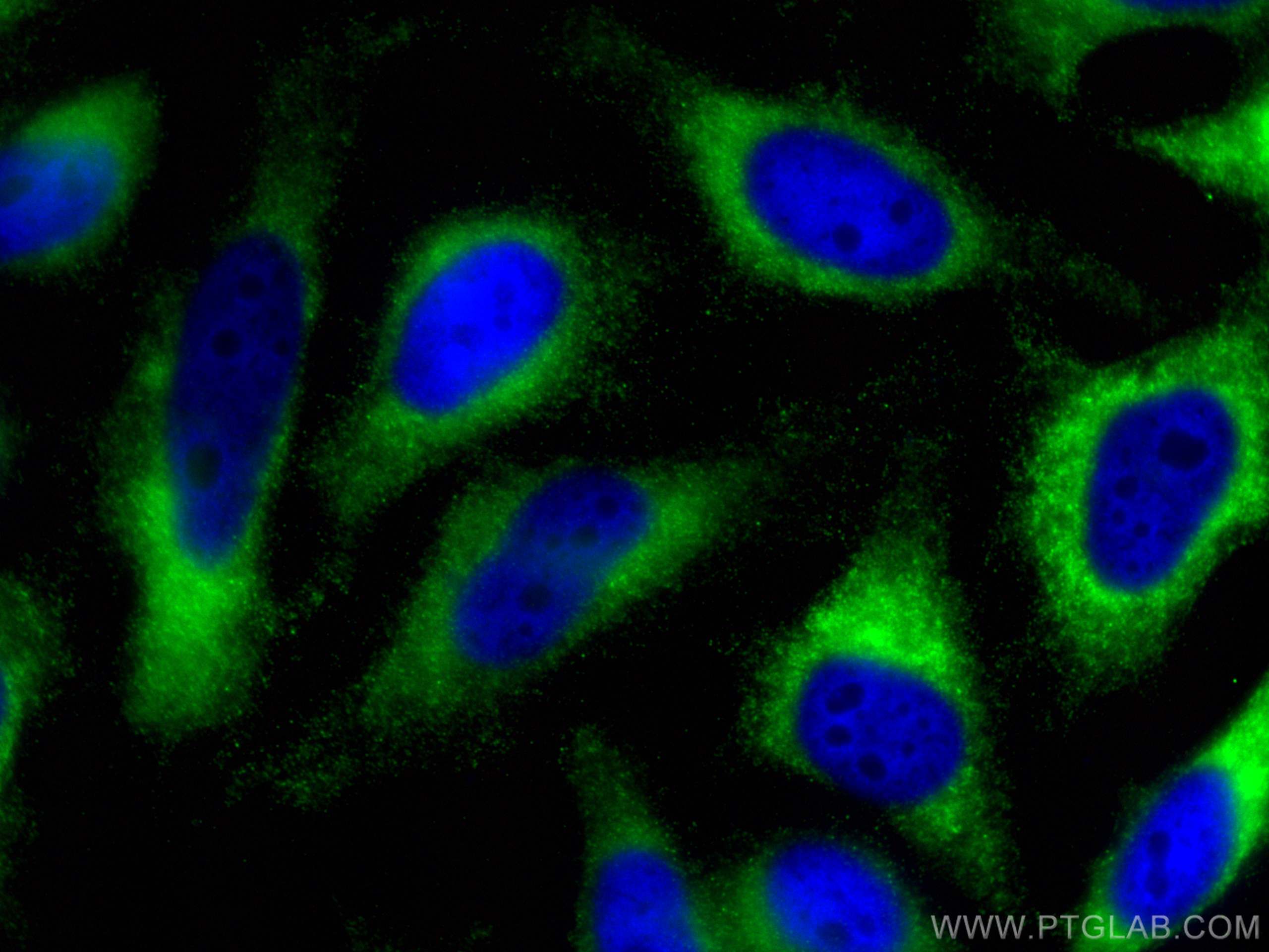 Immunofluorescence (IF) / fluorescent staining of HeLa cells using CCBL1 Polyclonal antibody (30296-1-AP)