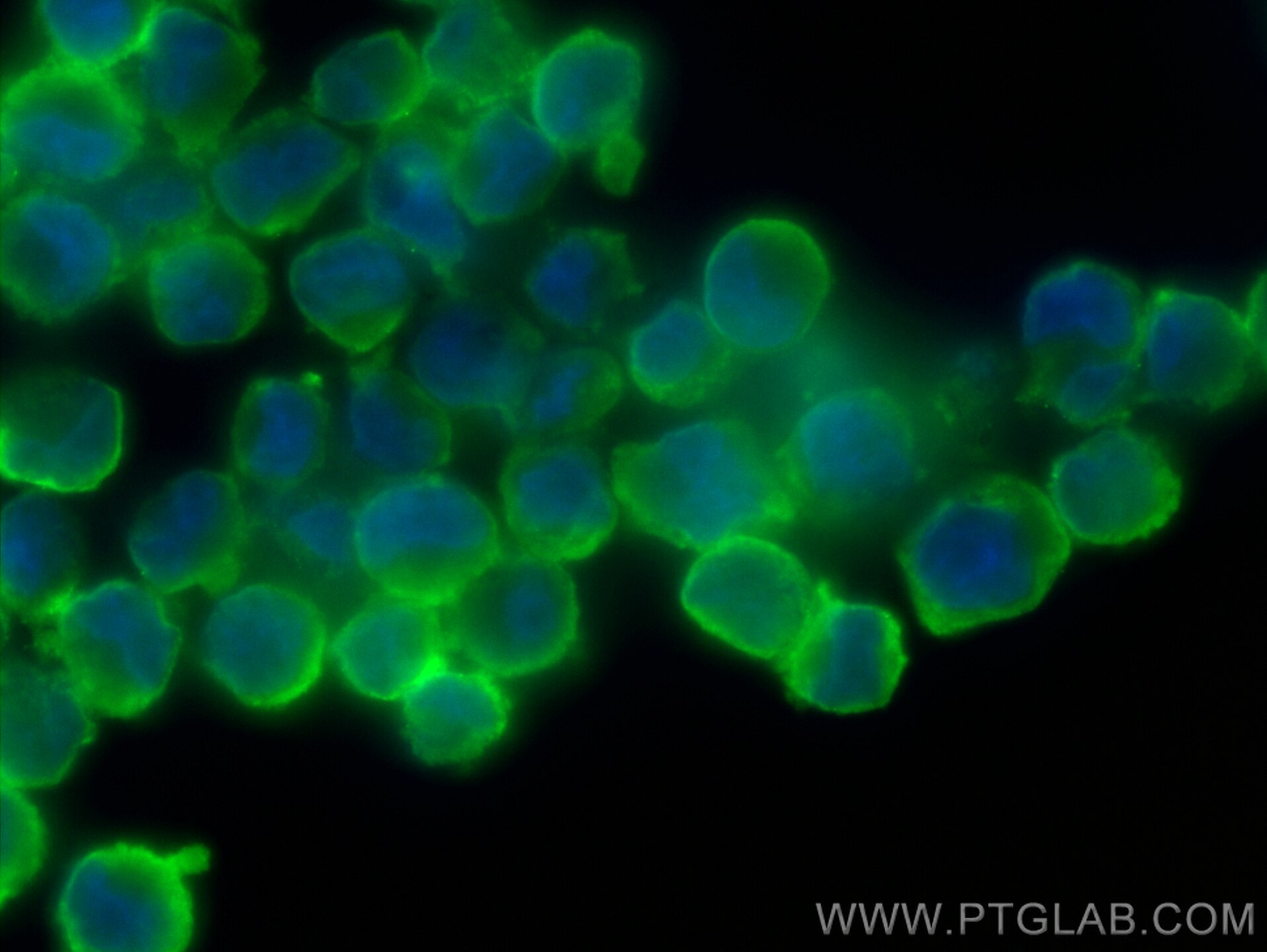Immunofluorescence (IF) / fluorescent staining of K-562 cells using CCBL2 Polyclonal antibody (55476-1-AP)