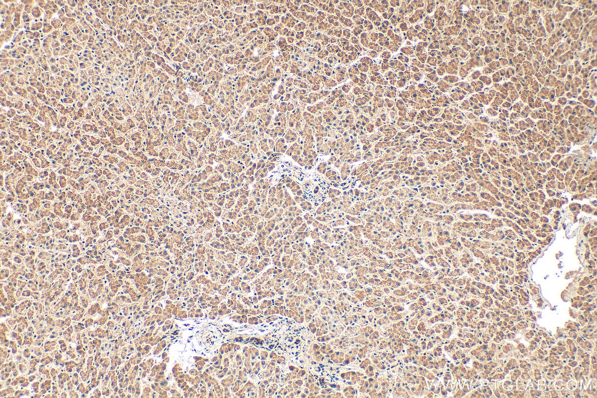 Immunohistochemistry (IHC) staining of human liver tissue using CCBL2 Polyclonal antibody (55476-1-AP)