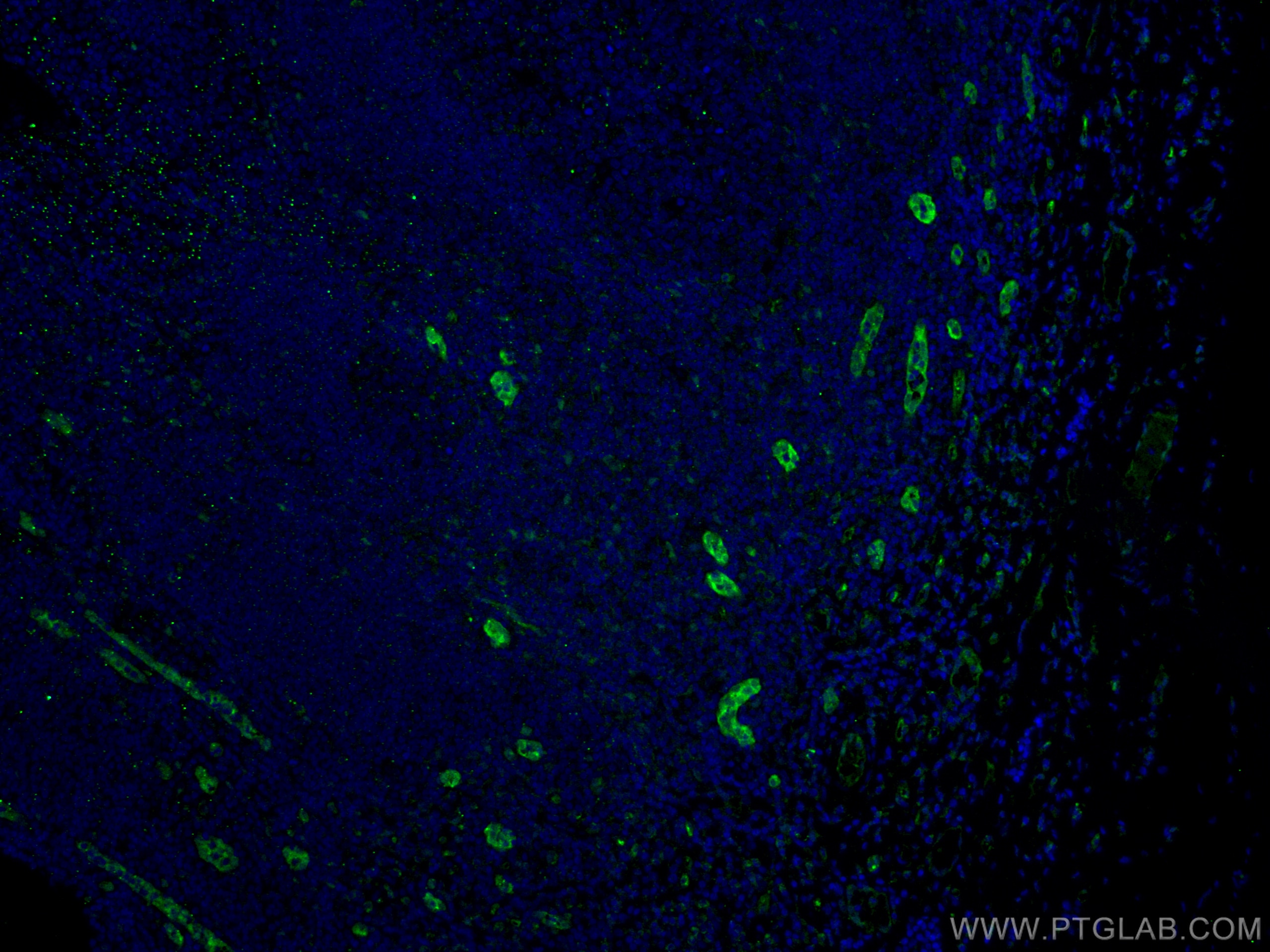 Immunofluorescence (IF) / fluorescent staining of human tonsillitis tissue using ACKR2 Monoclonal antibody (60046-1-Ig)