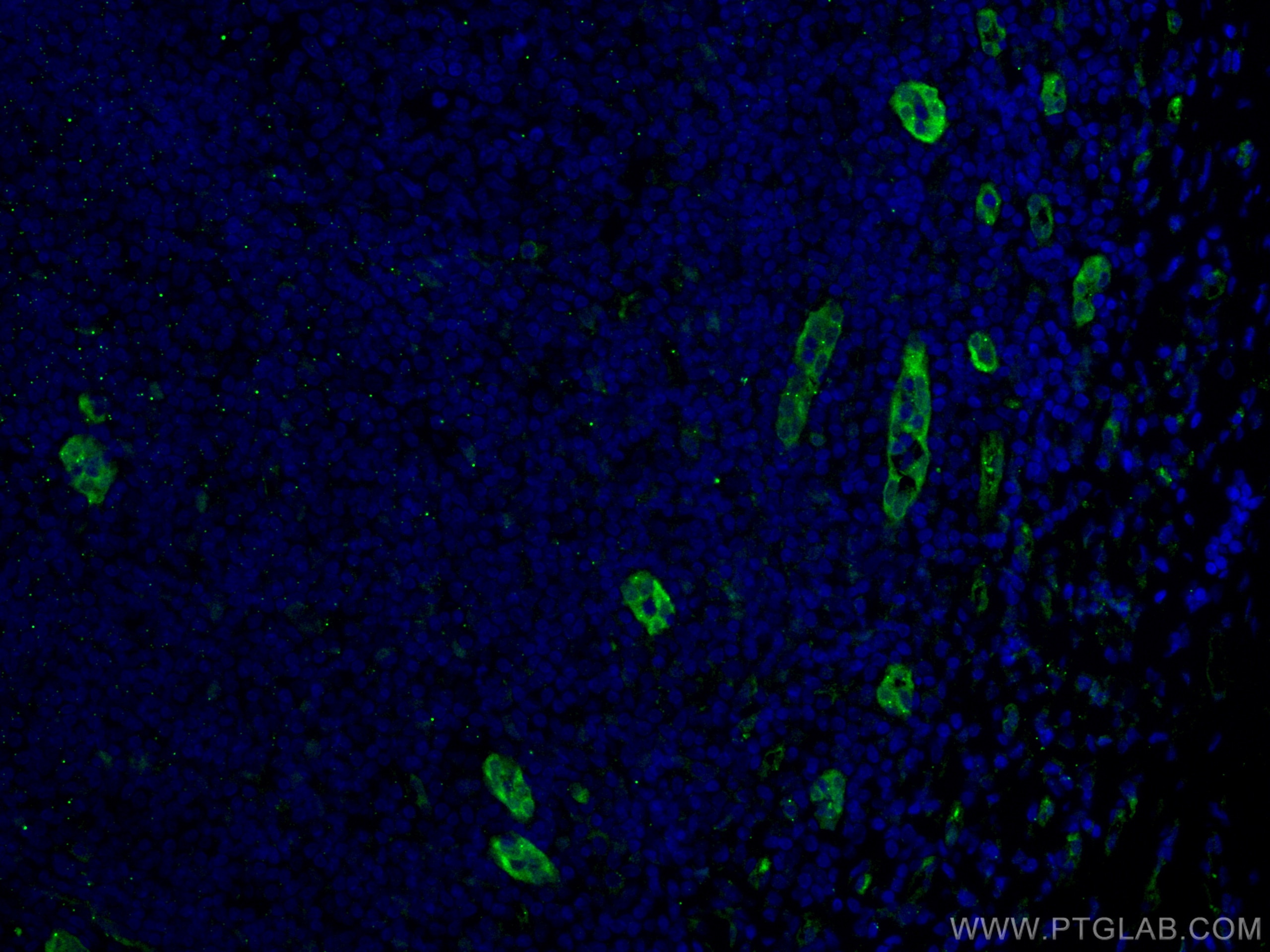 Immunofluorescence (IF) / fluorescent staining of human tonsillitis tissue using ACKR2 Monoclonal antibody (60046-1-Ig)