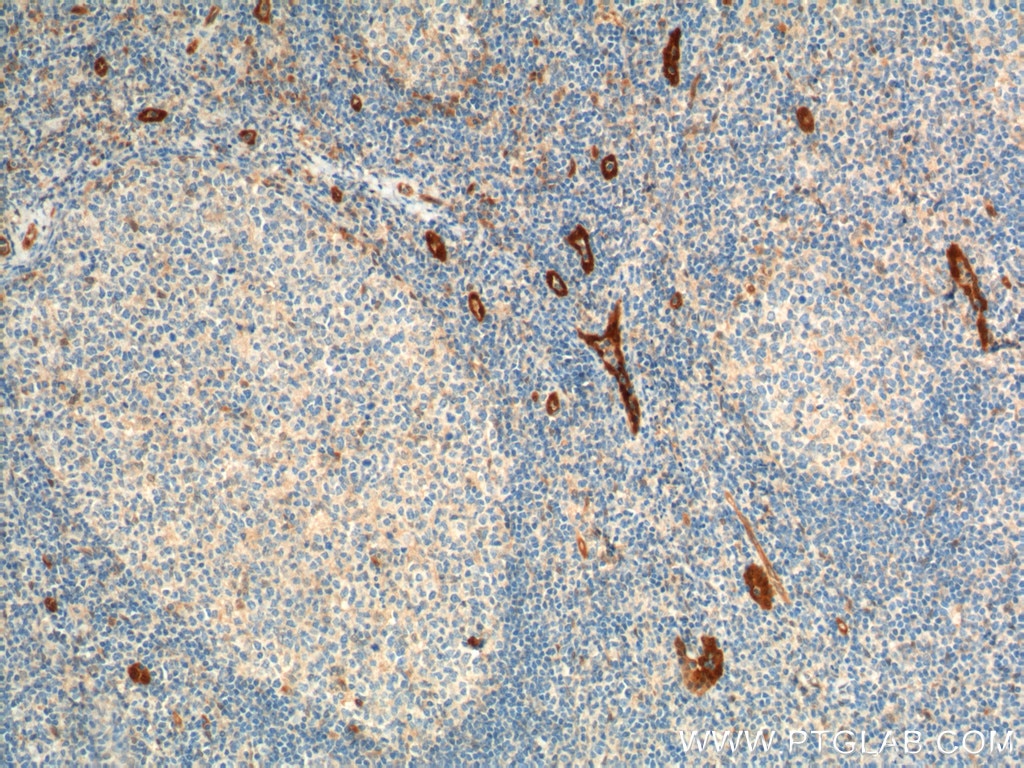 Immunohistochemistry (IHC) staining of human tonsillitis tissue using ACKR2 Monoclonal antibody (60046-1-Ig)