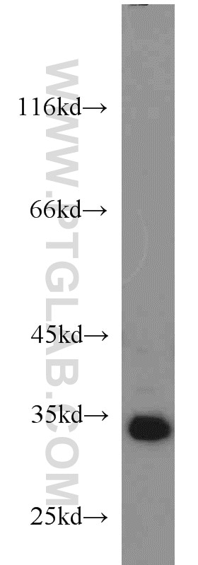 Western Blot (WB) analysis of HeLa cells using SGF29 Polyclonal antibody (24061-1-AP)