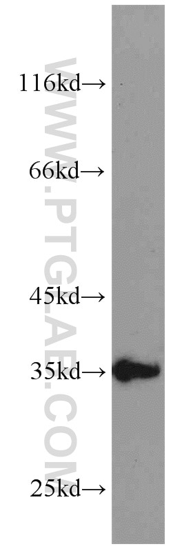 Western Blot (WB) analysis of MDA-MB-453s cells using SGF29 Polyclonal antibody (24061-1-AP)