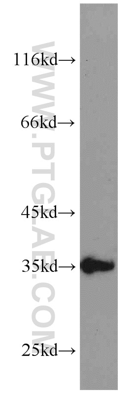 WB analysis of MDA-MB-453s using 24061-1-AP