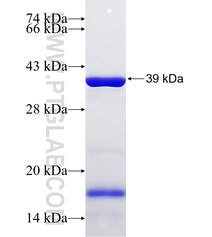 CCDC101 fusion protein Ag33219 SDS-PAGE