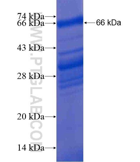 CCDC101 fusion protein Ag21261 SDS-PAGE