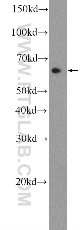 Western Blot (WB) analysis of HeLa cells using CCDC102A Polyclonal antibody (25764-1-AP)