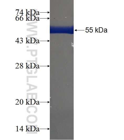 CCDC102A fusion protein Ag22753 SDS-PAGE