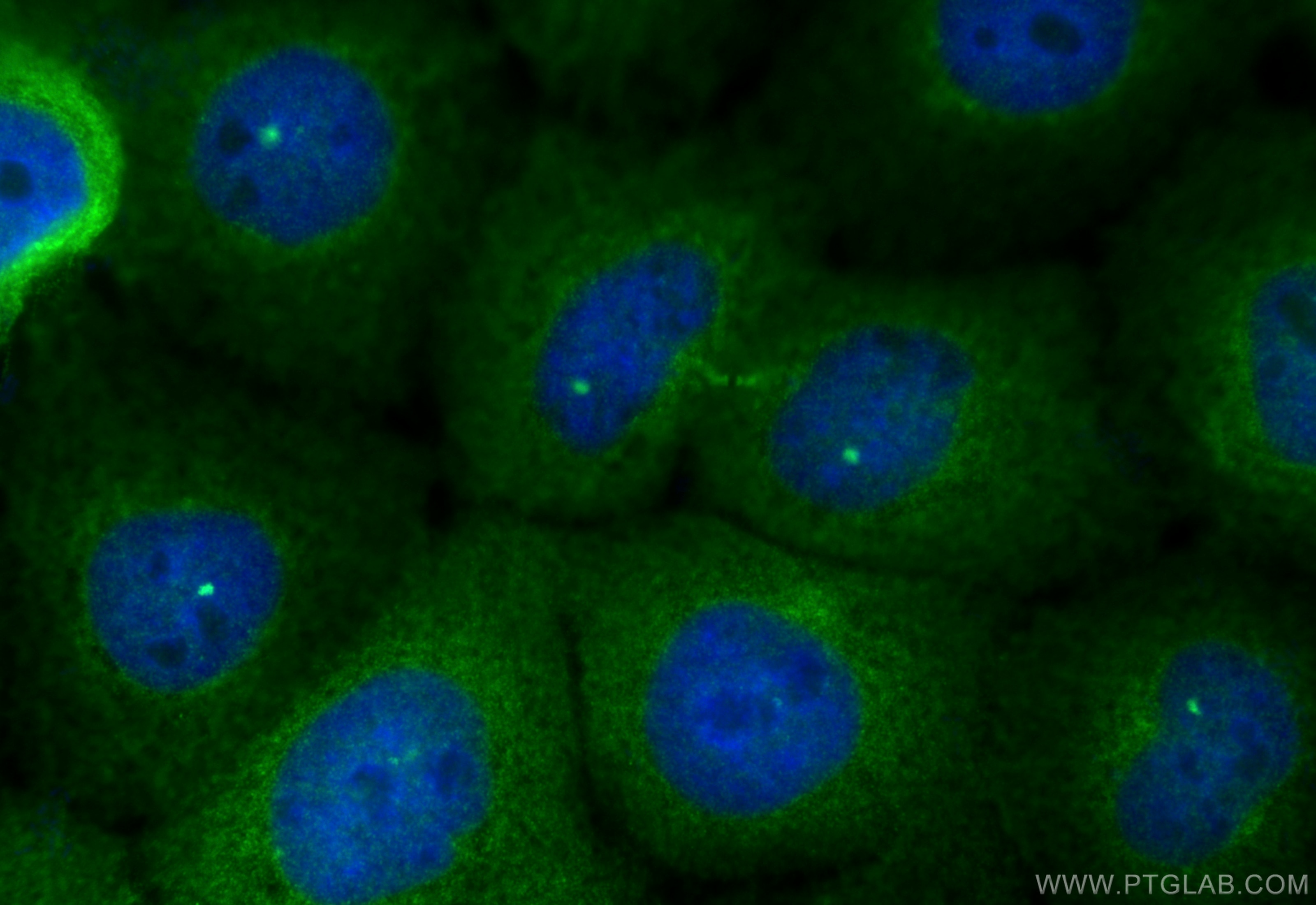 Immunofluorescent analysis of (4% PFA) fixed A431 cells using CCDC102B antibody (31675-1-AP) at dilution of 1:200 and Multi-rAb CoraLite ® Plus 488-Goat Anti-Rabbit Recombinant Secondary Antibody (H+L) (RGAR002). Immunofluorescence (IF) / fluorescent staining of A431 cells using CCDC102B Polyclonal antibody (31675-1-AP)