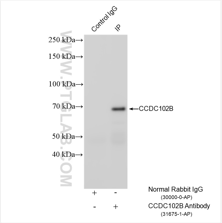 IP result of anti-CCDC102B (IP:31675-1-AP, 4ug; Detection:31675-1-AP 1:800) with SH-SY5Y cells lysate 1240 ug. Immunoprecipitation (IP) experiment of SH-SY5Y cells using CCDC102B Polyclonal antibody (31675-1-AP)