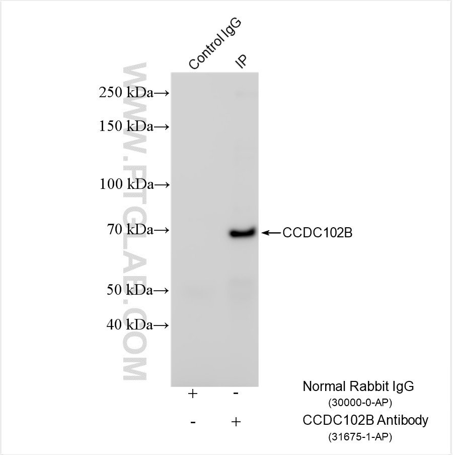 IP result of anti-CCDC102B (IP:31675-1-AP, 4ug; Detection:31675-1-AP 1:800) with MOLT-4 cells lysate 1800 ug. Immunoprecipitation (IP) experiment of MOLT-4 cells using CCDC102B Polyclonal antibody (31675-1-AP)