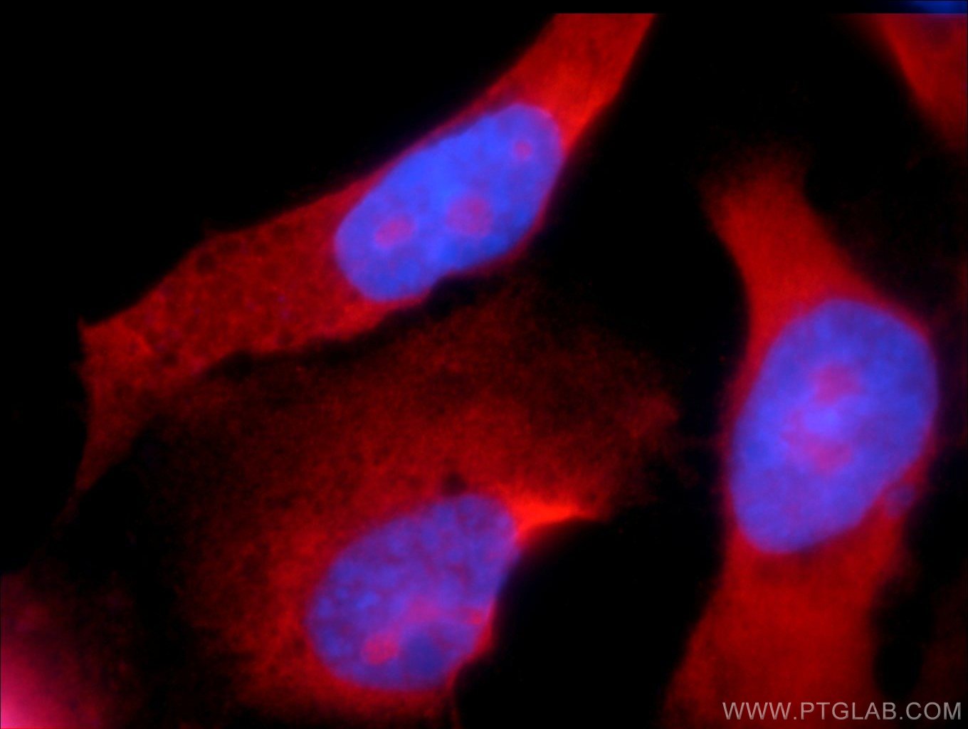 Immunofluorescence (IF) / fluorescent staining of A431 cells using CCDC104 Polyclonal antibody (24276-1-AP)