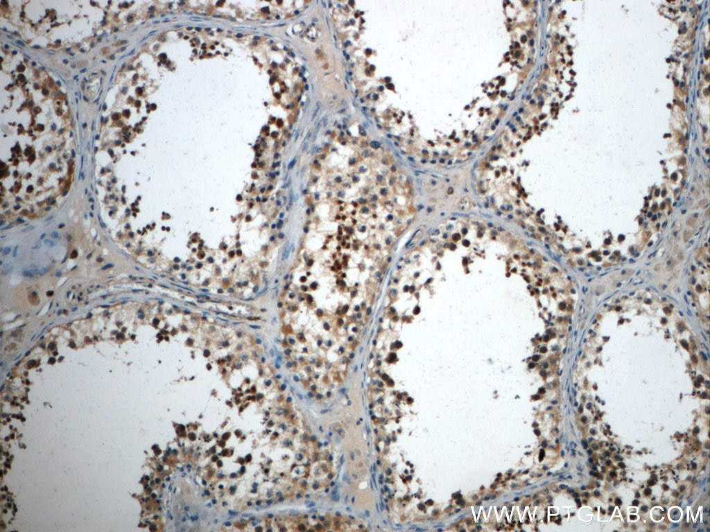 Immunohistochemistry (IHC) staining of human testis tissue using CCDC104 Polyclonal antibody (24276-1-AP)