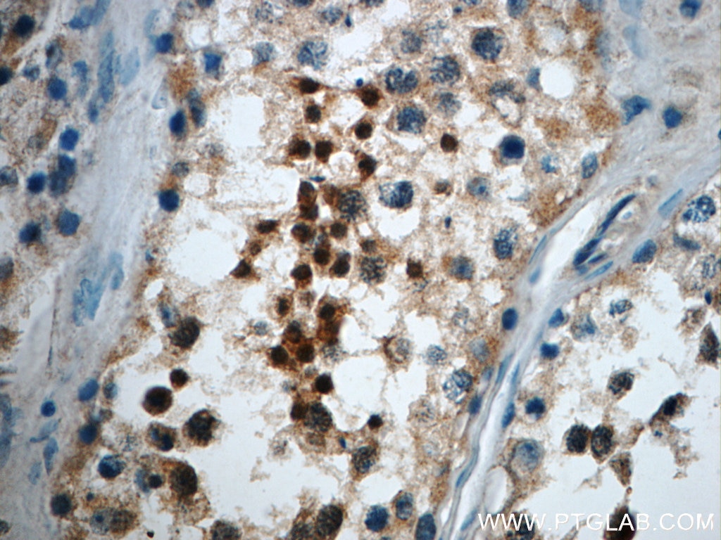 Immunohistochemistry (IHC) staining of human testis tissue using CCDC104 Polyclonal antibody (24276-1-AP)