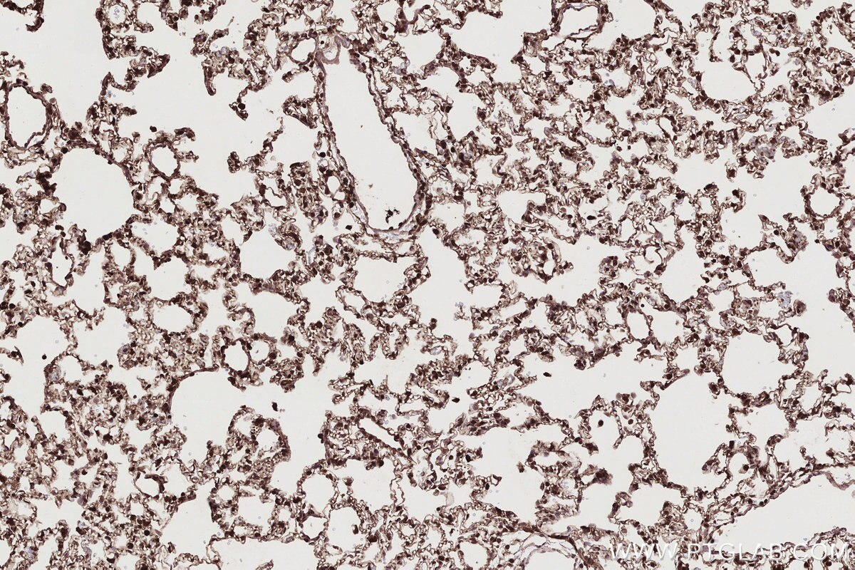 Immunohistochemistry (IHC) staining of rat lung tissue using CFAP36 Polyclonal antibody (24276-1-AP)